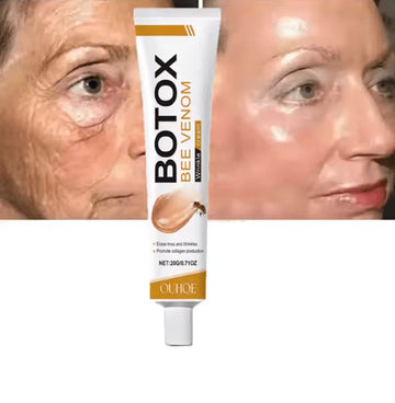 Botox Wrinkle Cream
